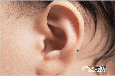 耳后长痣位置决定命运 耳朵后有痣的命运图解