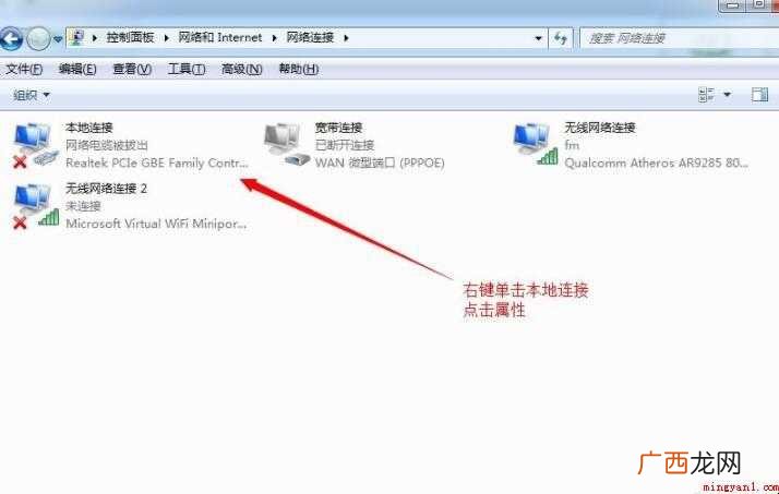 怎么设置本地连接ip地址