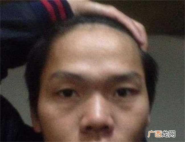 额头上有两个凸起面相好吗 额头有两个凸起的人面相怎么样