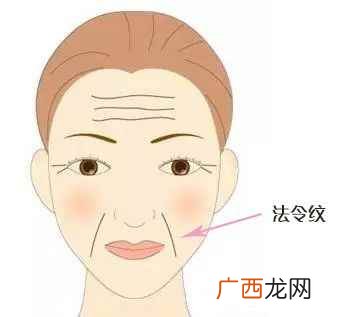 法令纹怎么锻炼会消除 法令纹深是什么原因导致的