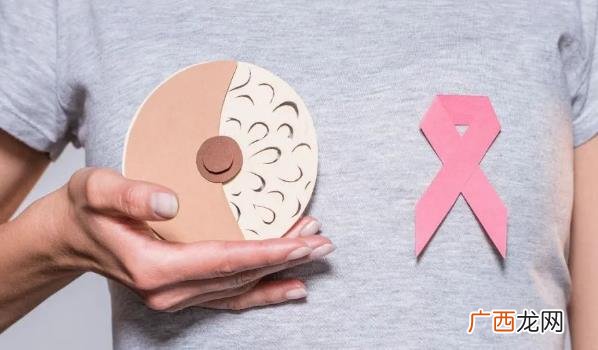 乳腺癌的分类、诊断、治疗、随访和管理等方面内容 ?新版乳腺癌诊疗指南发布
