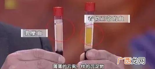 什么是血管的清道夫 血管清道夫清理血管的好方法