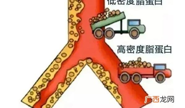 什么是血管的清道夫 血管清道夫清理血管的好方法