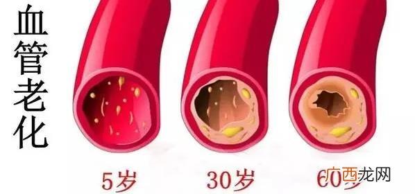 什么是血管的清道夫 血管清道夫清理血管的好方法