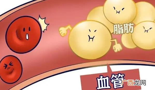 什么是血管的清道夫 血管清道夫清理血管的好方法