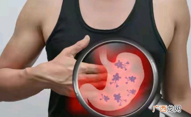 ?专家为何呼吁人们重视肠胃镜检查？