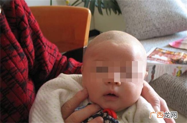 新生儿有没有必要“剃胎毛”？想拥有一头秀发，可以试试这样做