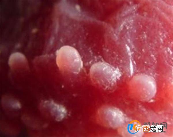 龟头炎是性病吗 龟头炎可以自愈吗