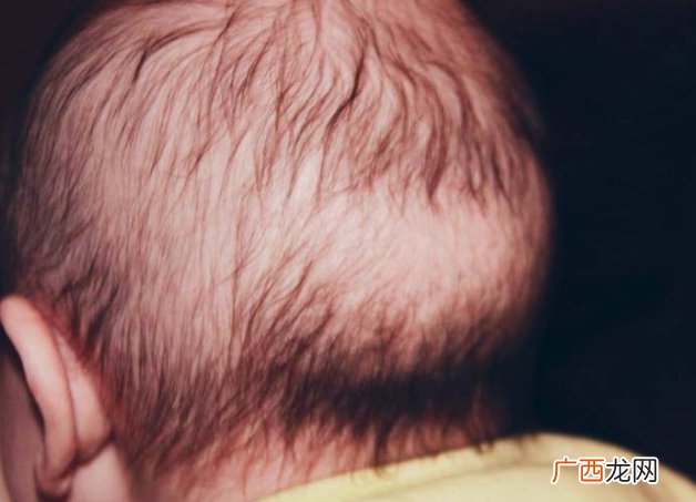 要想宝宝头发好，平时护理少不了！妈妈们给宝宝洗对了吗？