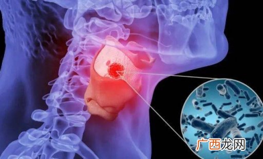 咽喉疼痛需先摸清病因 咽喉痛是“二阳”？