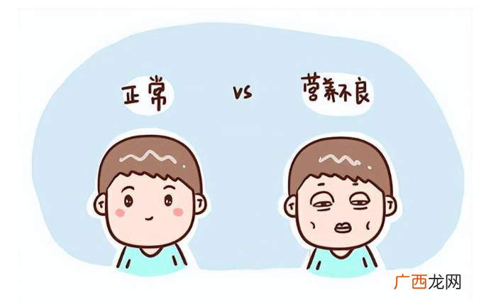 家长们注意 儿童营养不良的这几个表现 一定要重视