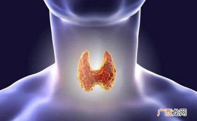 甲状腺结节发生率在20%以上 甲状腺结节是怎么形成的？