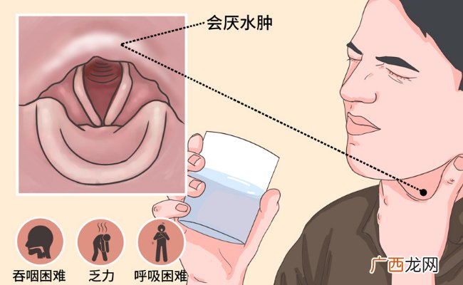 女子嗓子疼从就诊到去世仅10分钟 是什么原因导致一个人在这么短时间内死亡呢?