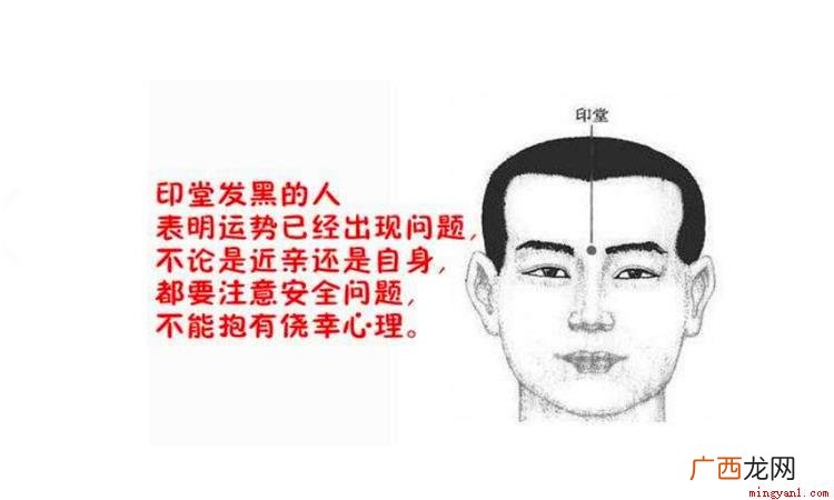 印堂发黑又代表着什么含义 印堂发黑是怎么回事