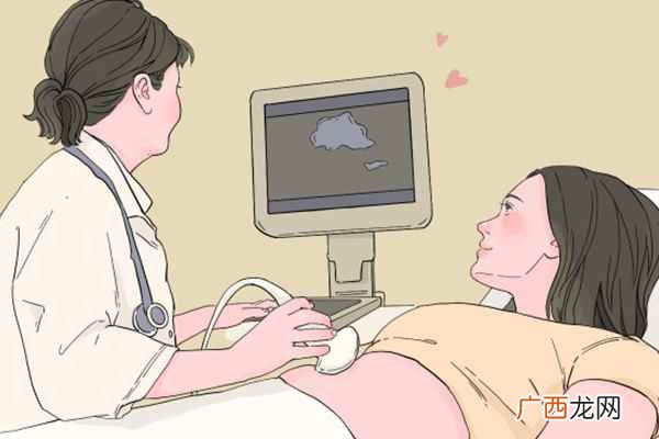 孕妇能吃黄花菜吗