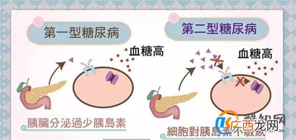 男子13岁得糖尿病27岁进ICU 熬夜吸烟暴饮暴食 如何预防_酷知科普