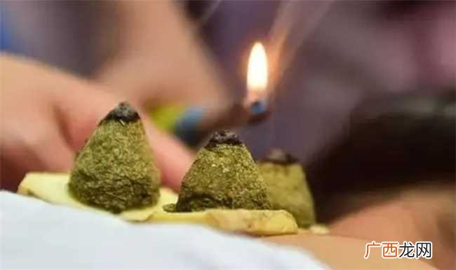三伏灸什么时间段做最好 三伏灸上午做好还是下午做好