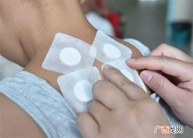 三伏灸的作用功效及注意事项 三伏灸可以调理什么病