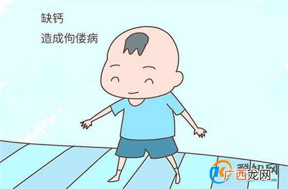 婴儿缺钙有什么表现和症状婴儿缺钙最明显的征兆