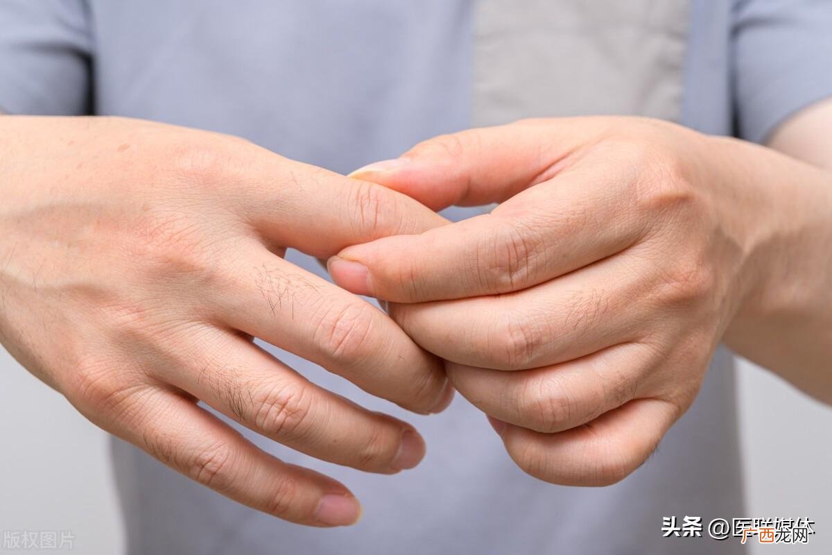 2类食物千万不要吃 高尿酸饮食禁忌及食谱表