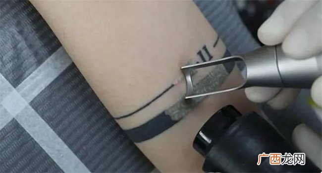 一位母亲的绝望：13岁女儿偷偷纹身 想清洗需要两年时间还会留疤