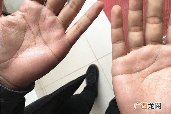 断掌纹男人命运怎么样左右 断掌纹男人命运怎么样