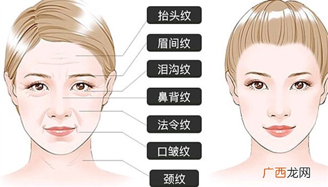 ?皱眉会产生皱纹么 皱纹去除的方法有哪些