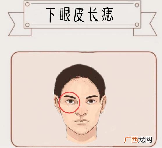 下眼皮长痣位置决定命运 下眼皮长痣代表什么意思