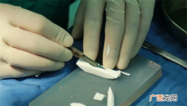 ?硅胶隆鼻有什么副作用吗硅胶隆鼻安全吗