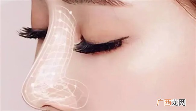 ?硅胶隆鼻有什么副作用吗硅胶隆鼻安全吗
