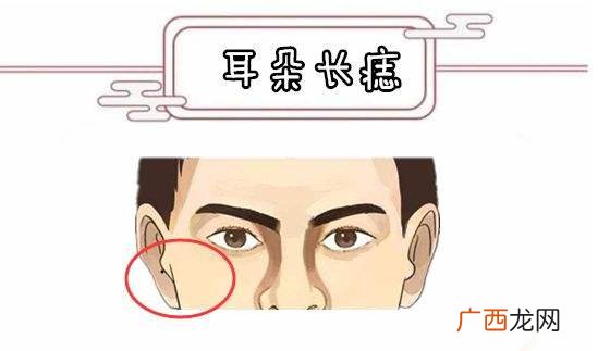 耳朵长痣相图解大全 耳朵上有痣代表什么意思