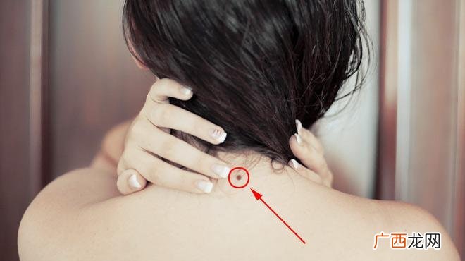 图解 脖子正后方有痣的女人命运好不好?