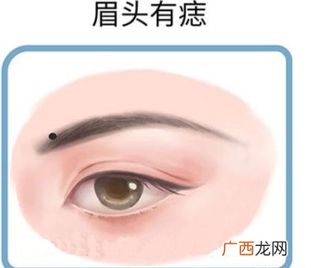 眉毛里有痣图解 眉毛有痣好不好