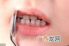 上牙代表父母下牙代表儿女的说法