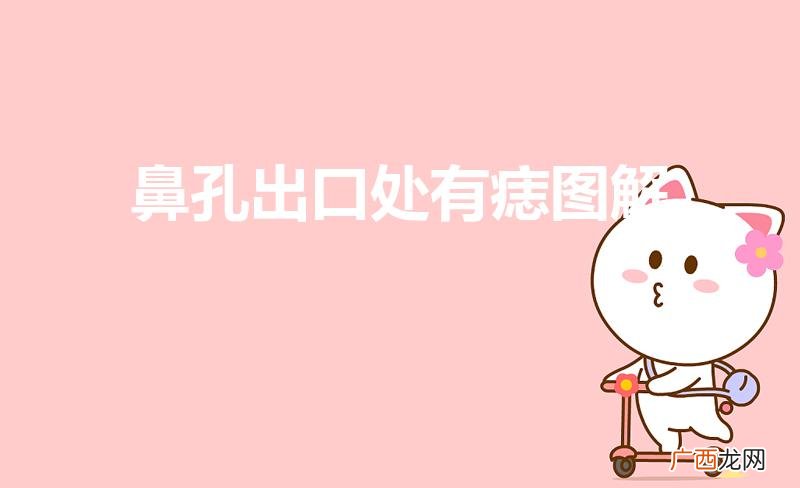 鼻子口有个痣代表什么意思 鼻孔出口处有痣图解