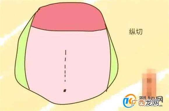 越来越多的孕妇喜欢剖腹产，原来是这几个原因，你能猜到几个？