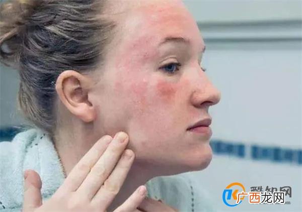 拔火罐吸出来的瘀血，是体内的毒素？揭秘其中真相，涨知识了