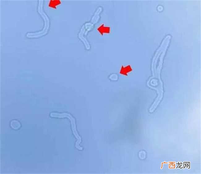 视觉健康远离飞蚊症该怎么做 关注视觉健康