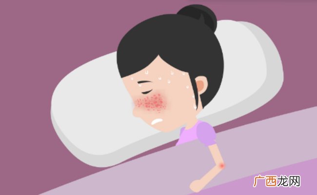 红斑狼疮是什么病