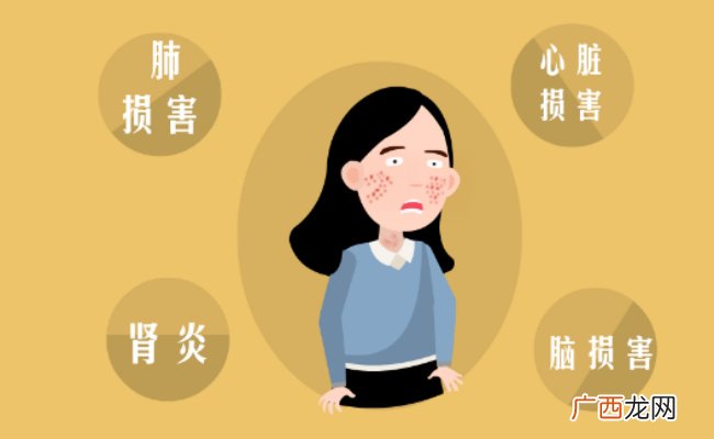红斑狼疮是什么病