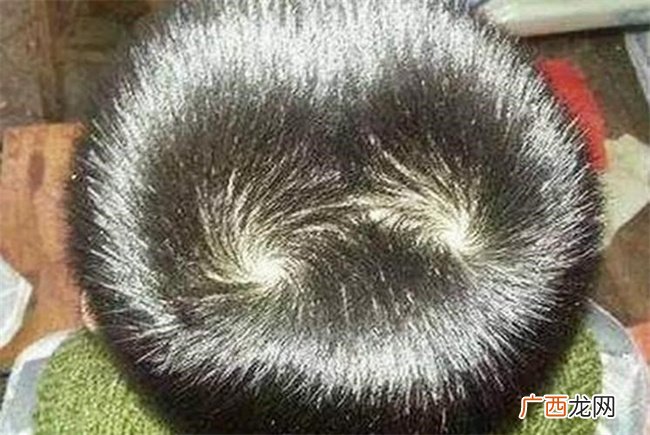 发旋有两个有什么好处