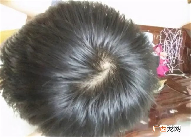 发旋有两个有什么好处