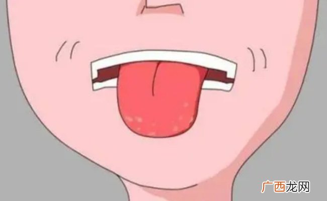 吃橙子舌头麻怎么回事吃橙子舌头变黄正常吗