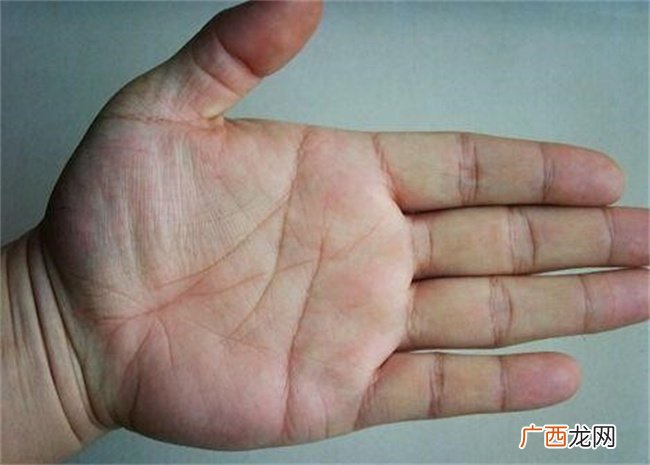 手相太阳丘凹陷是怎样的