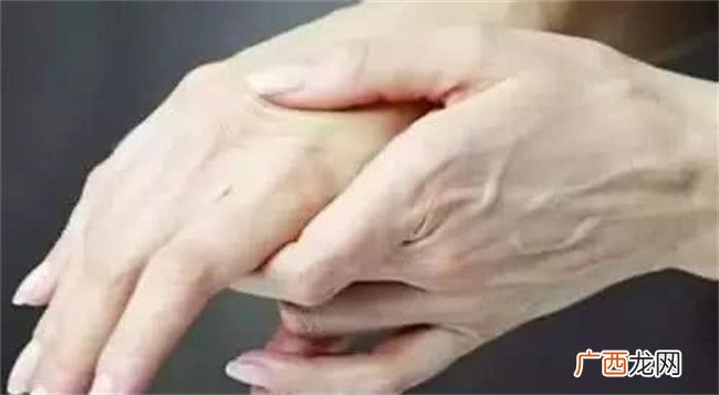 手背青筋显露是否代表劳累命相