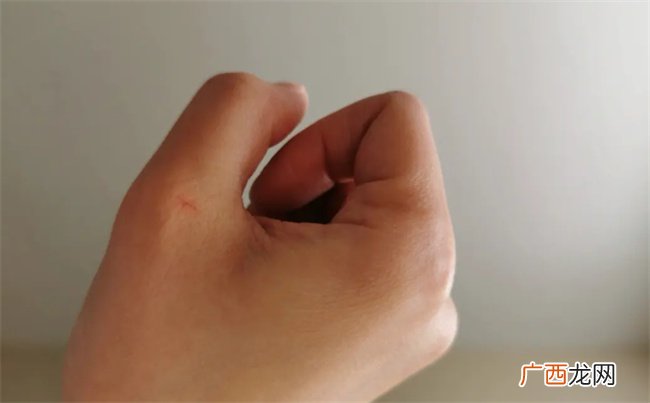 孩子喜欢挠人怎么管教 宝宝总挠人打人怎么办