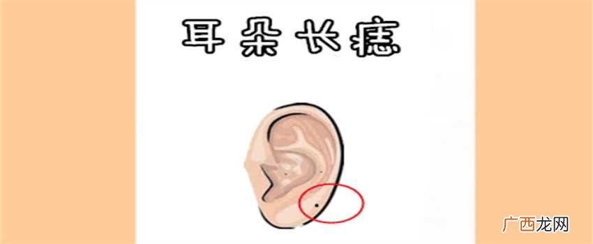 男人耳朵长痣的分析 是福 男人耳朵长痣是福是祸