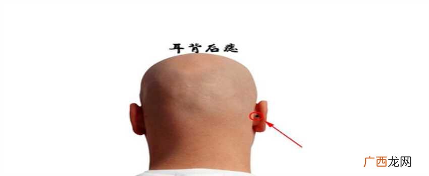 耳垂长痣，耳背长痣，耳内长痣 耳朵长痣的秘密图解
