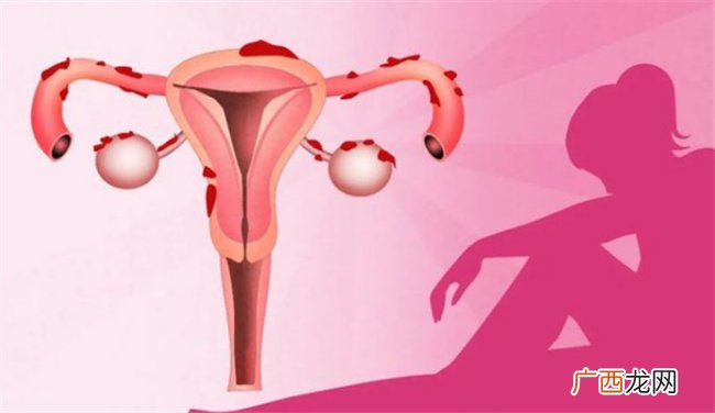 生育力保护应贯穿女性一生多个阶段吗