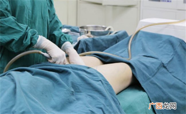 中国女子在韩接受抽脂手术后死亡了吗